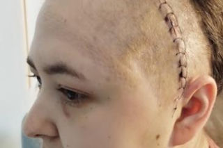 Życie Moniki wywróciło się do góry nogami. Torunianka walczy z glejakiem