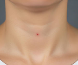 Donald Trump i tajemnicza plama. Co ujawnił jego lekarz?