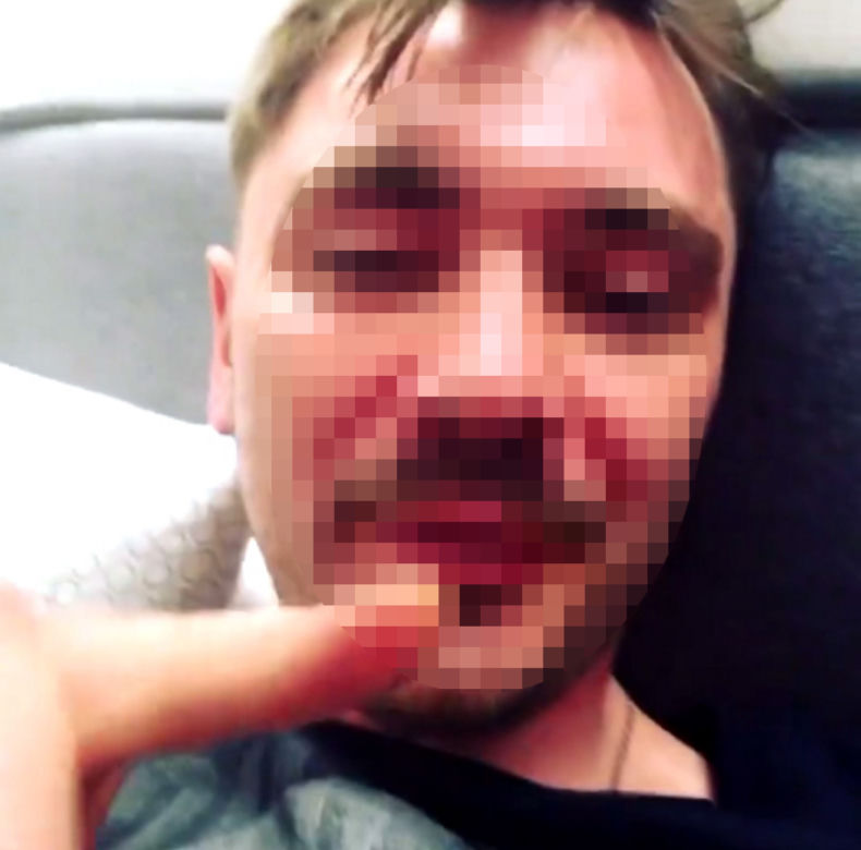Syn Zenka dostał gazem w twarz