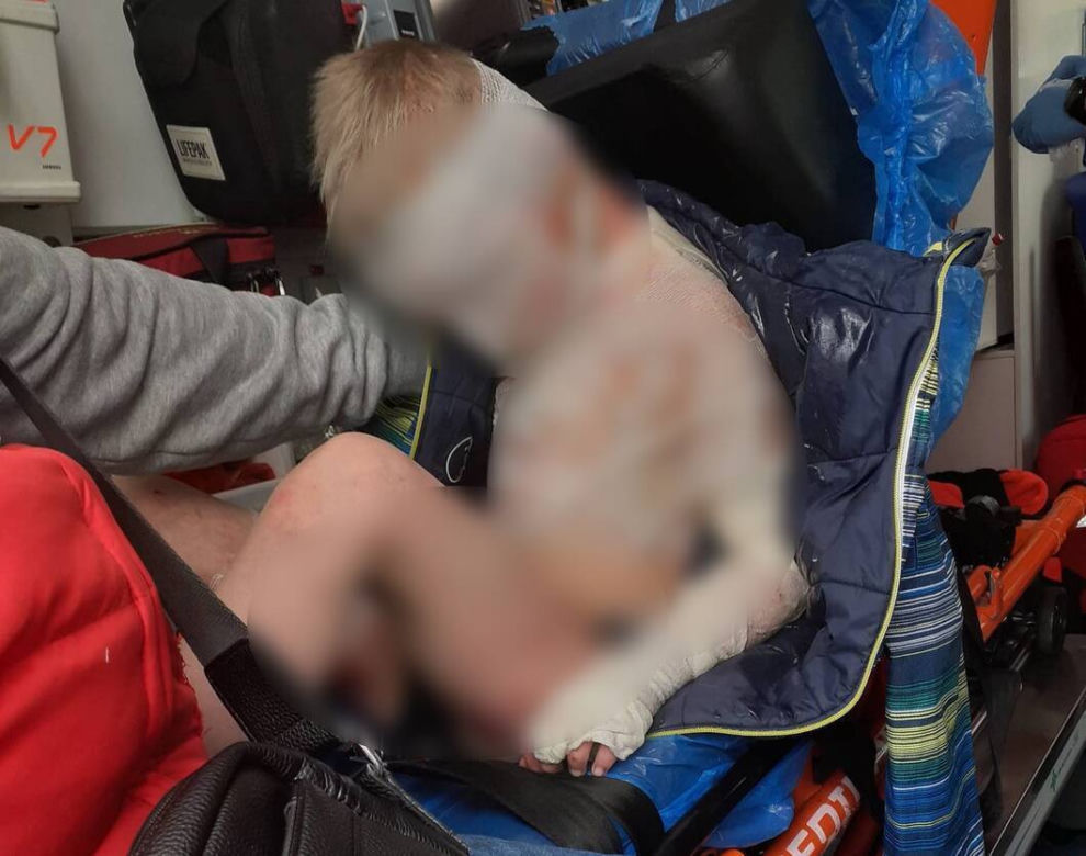 Ośmioletni Kamil z Częstochowy był katowany od tygodni