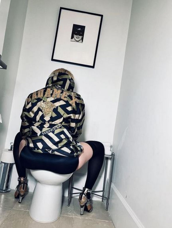 Madonna z wielkim siniakiem. Kto jej to zrobił?