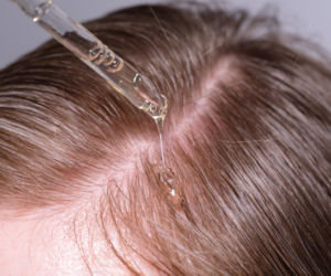 Hair slugging bije rekordy popularności. Ale przez jeden błąd cierpi skóra głowy 
