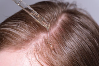 Hair slugging bije rekordy popularności. Ale przez jeden błąd cierpi skóra głowy 