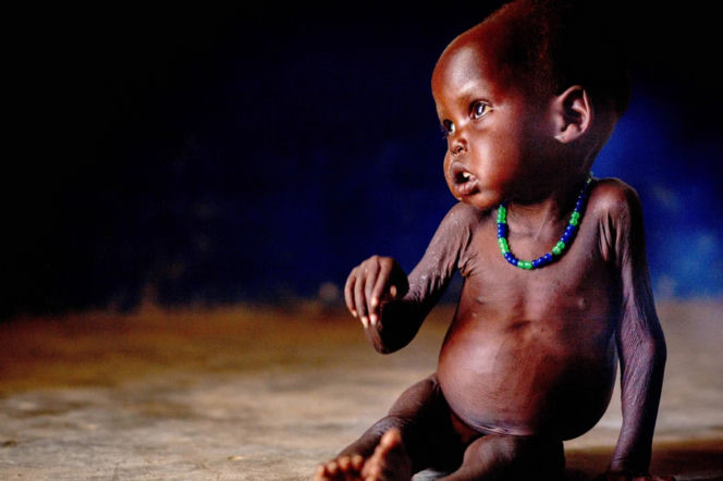 głód afryka unicef