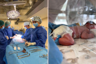 „Im więcej płodów w macicy, tym większe ryzyko”. Ginekolog-położnik przeprowadza nas przez każdy etap ciąży mnogiej