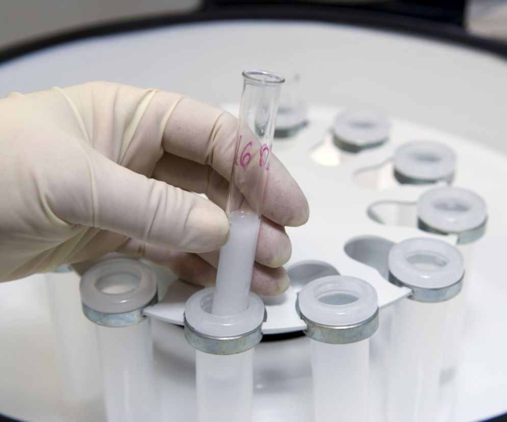 in vitro