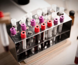 Boisz się o swoją przyszłość? Proste badanie krwi wyliczy, ile lat życia ci zostało