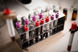 Boisz się o swoją przyszłość? Proste badanie krwi z 86 proc. dokładnością wyliczy, ile lat życia ci zostało