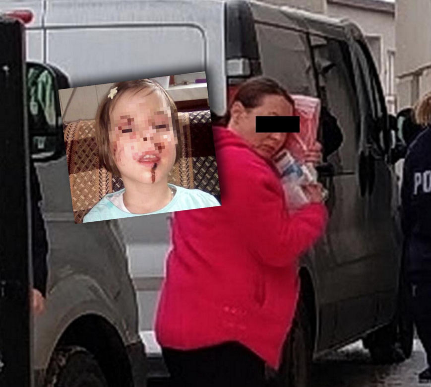 Wyrodna matka zgotowała Julce piekło. Latami wypalała jej kwasem rany na skórze!