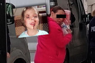 Wyrodna matka zgotowała Julce piekło. Latami wypalała jej kwasem rany na skórze! Dziewczynka potrzebuje pomocy