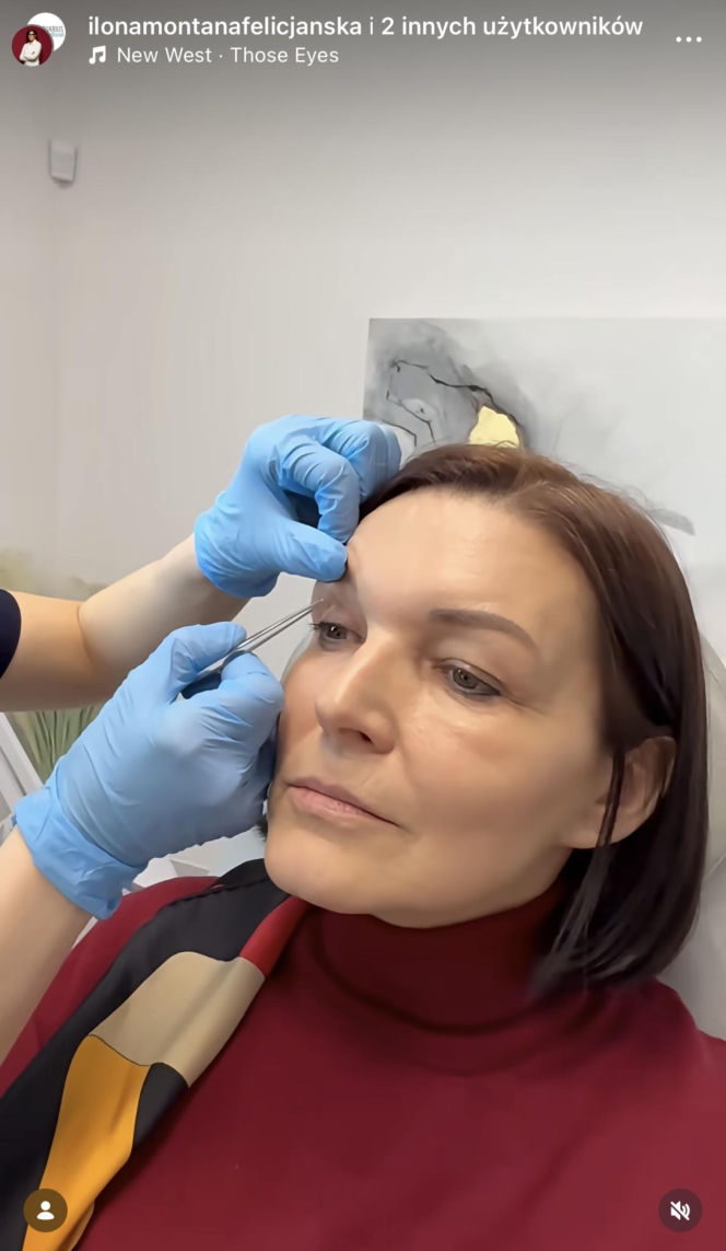 Ilona Felicjańska wycina sobie powieki