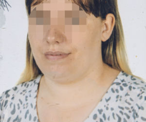 Lekarze zaszyli jej łyżkę w brzuchu. Umarła.