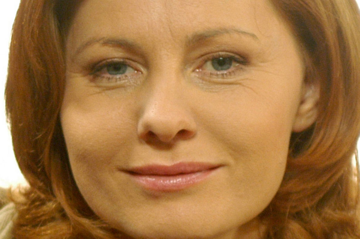Ewa Skibińska - spuchły jej usta