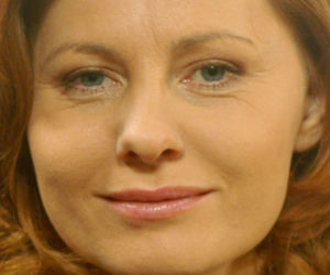 Ewa Skibińska - spuchły jej usta