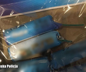 4-latek stracił dwa palce. Petarda wybuchła mu w ręce! [ZDJĘCIA]