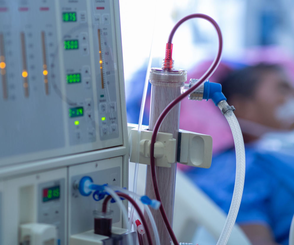 Chore nerki to główny czynnik hospitalizacji z powodu COVID-19. Nowe badanie