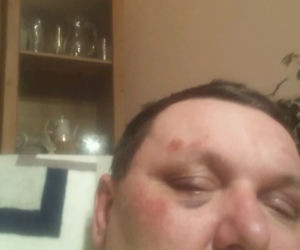 Wrocławianin twierdzi, że został pobity i skopany w radiowozie