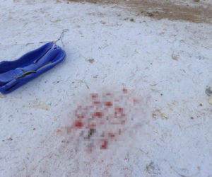 12-letni Dawid zjeżdżał z górki, nie żyje. Uderzył głową o ławkę