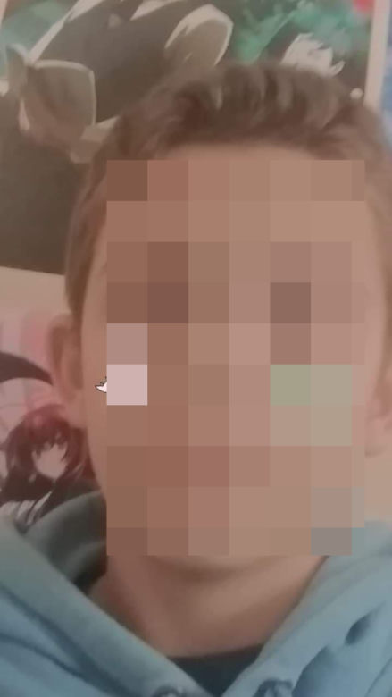 Grodzisko Górne. 12-latek simsonem wjechał w dziewczynkę [ZDJĘCIA]