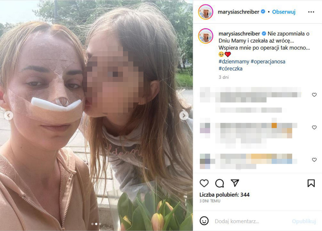 Tak wygląda Marianna Schreiber po operacji nosa