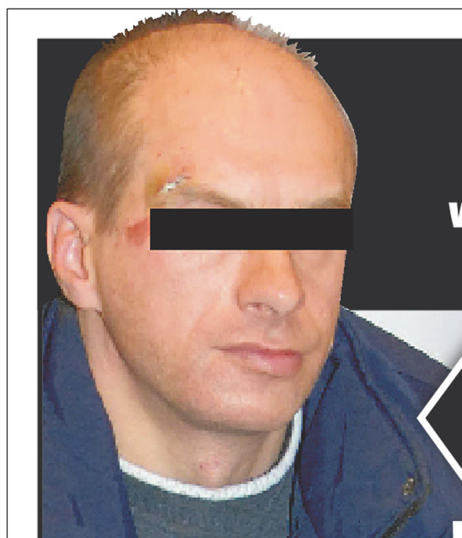 Łomiarz znów zaatakował