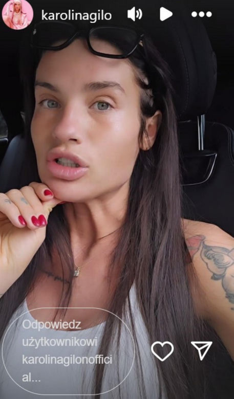 Karolina Gilon cierpi z bólu! Dopiero teraz przyznała się do tego 