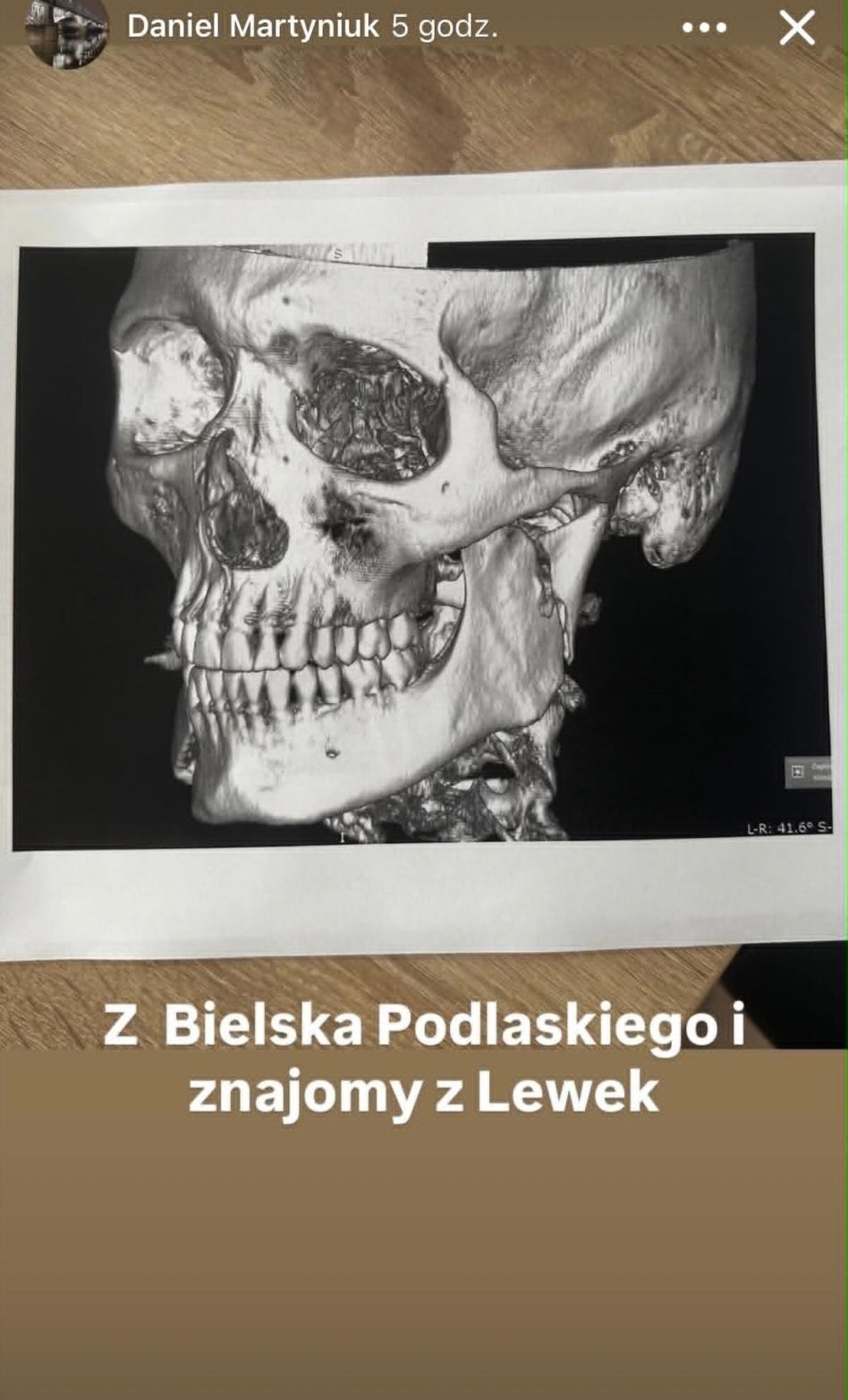 Daniel Martyniuk oskarża rodzinę o POBICIE. "Trzech na jednego" - co się wydarzyło?