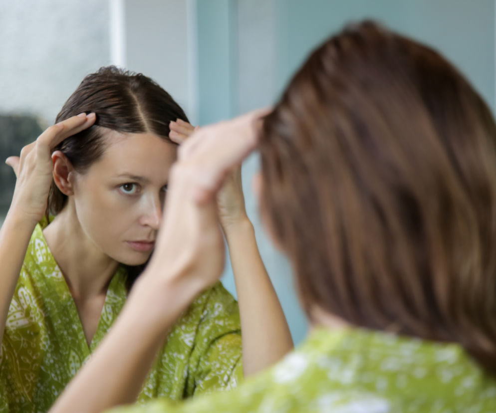 Łysienie androgenowe u kobiet - przyczyny, diagnostyka, sposoby leczenia