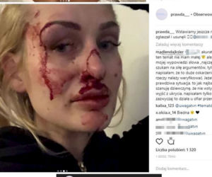 pobita dziewczyna trener osobisty