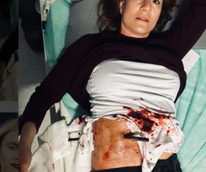 Maja Ostaszewska z prętem w brzuchu w serialu Diagnoza