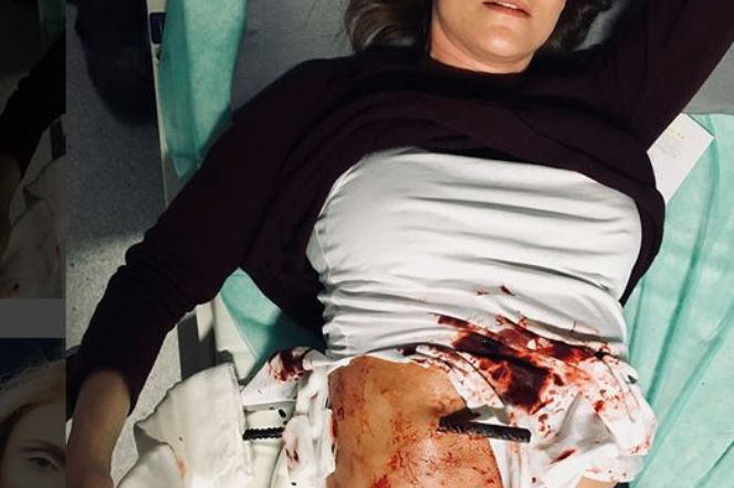 Maja Ostaszewska z prętem w brzuchu w serialu Diagnoza
