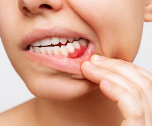 Spójrz w lustro i sprawdź dziąsła. Zmieniły kolor? Lekarze ostrzegają: to cichy sygnał, że serce wysiada