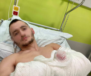 Pociął Franka, bo wjechał do lasu