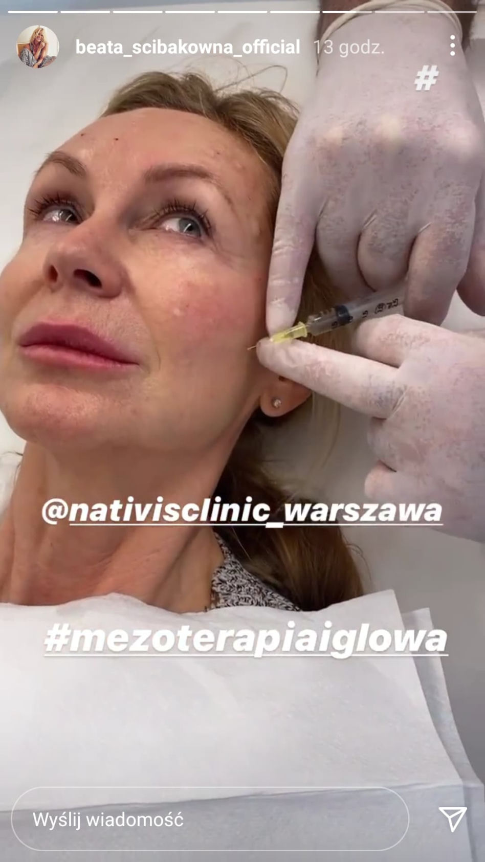 Beata Ścibakówna poprawiła sobie twarz i nie zakłada maseczki