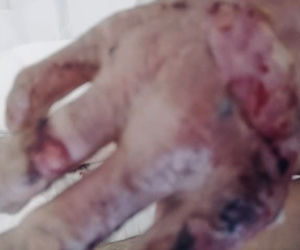 Dramat rodziny po wybuchu gazu. Ciężko poparzone dzieci.  Łzy na naszych policzkach płyną nieustannie [DRASTYCZNE ZDJĘCIA]