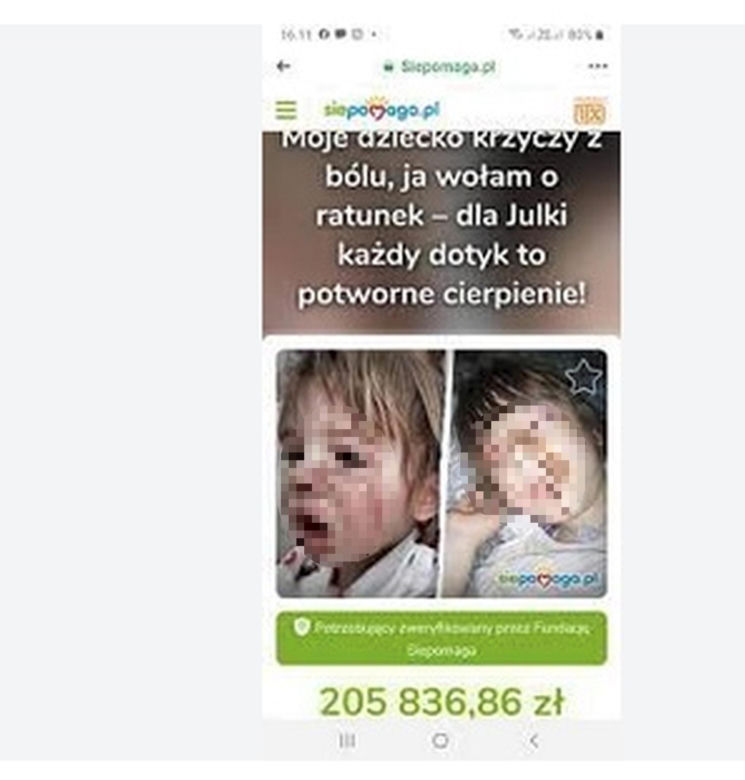 Spaliła kwasem ucho Julii. Rodzina broni wyrodnej matki, która latami torturowała 10-latkę