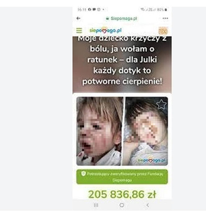 Spaliła kwasem ucho Julii. Rodzina broni wyrodnej matki, która latami torturowała 10-latkę