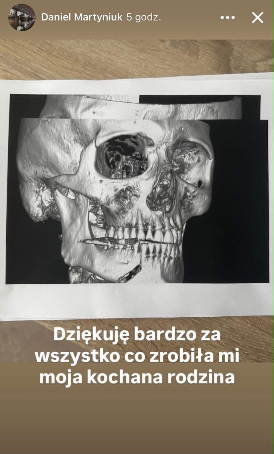 Daniel Martyniuk oskarża rodzinę o POBICIE. "Trzech na jednego" - co się wydarzyło?