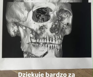 Daniel Martyniuk oskarża rodzinę o POBICIE. Trzech na jednego - co się wydarzyło?