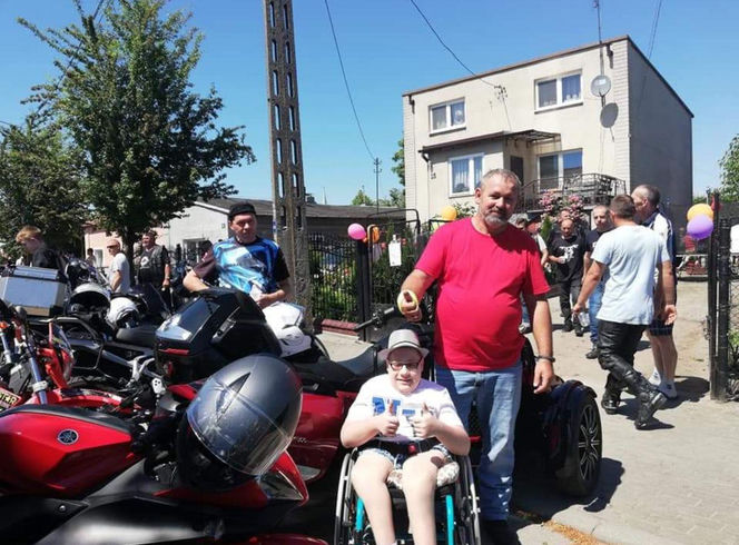 Gabryś przeszedł 17 operacji, tylko na twarzy i dłoniach nie ma blizn. Jego pają jest pomoc innym!