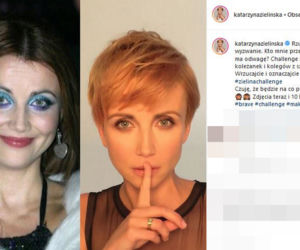 Katarzyna Zielińska pokazała w mediach społecznościowych jak zmieniła się jej twarz