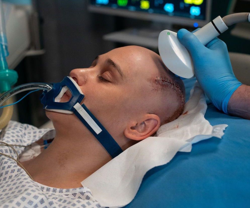 Pacjentka Iga po operacji tętniaka mózgu, z ogoloną głową i szwami, leży intubowana na szpitalnym łóżku, a jej głowa jest badana aparaturą medyczną. Scena z serialu Na dobre i na złe, o której więcej dowiesz się na Super Seriale.