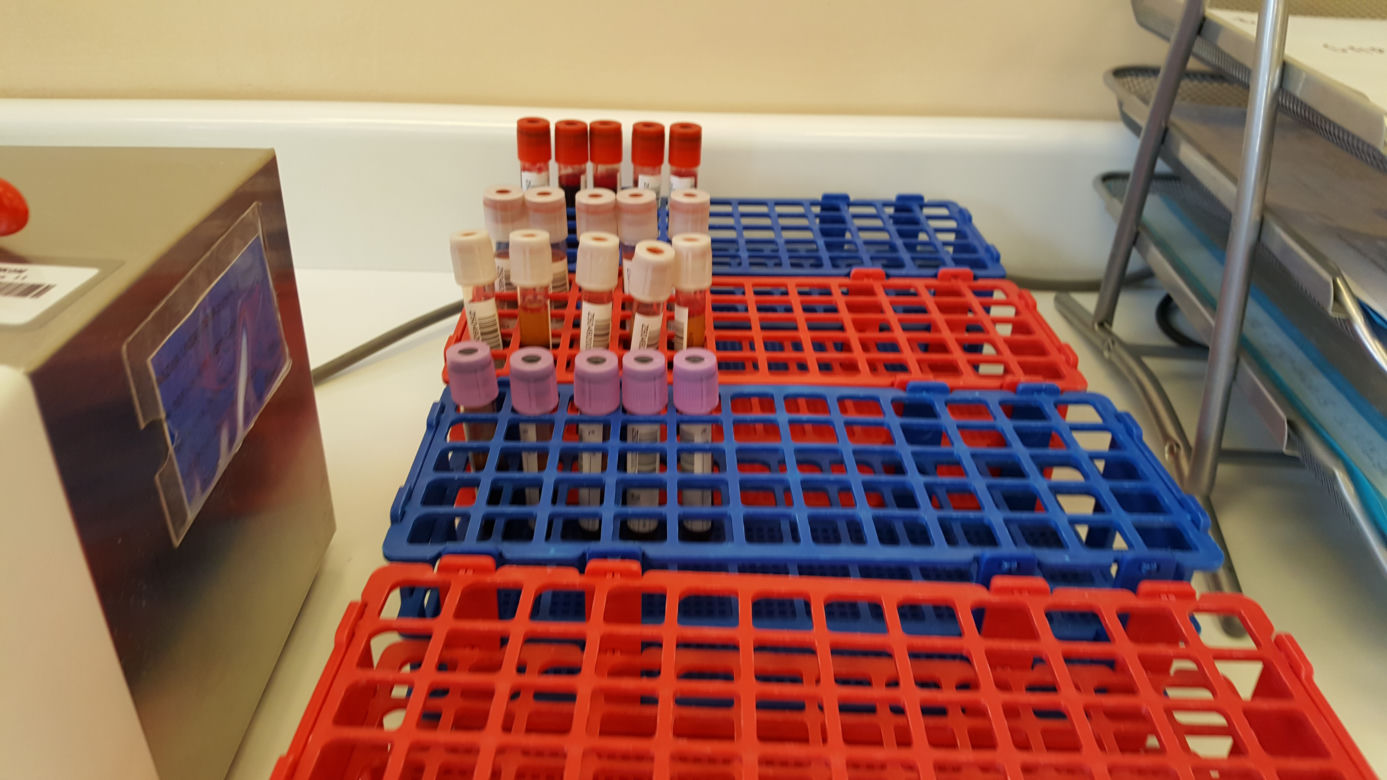 Koronawirus. Przez epidemię brakuje krwiodawców! Jak wygląda stan zapasów?