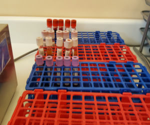 Koronawirus. Przez epidemię brakuje krwiodawców! Jak wygląda stan zapasów?
