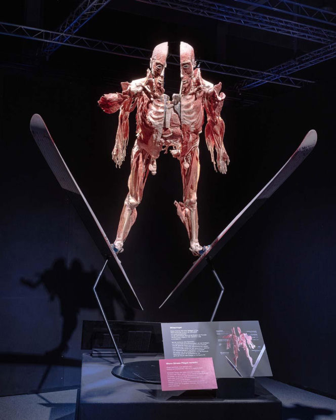 Body Worlds