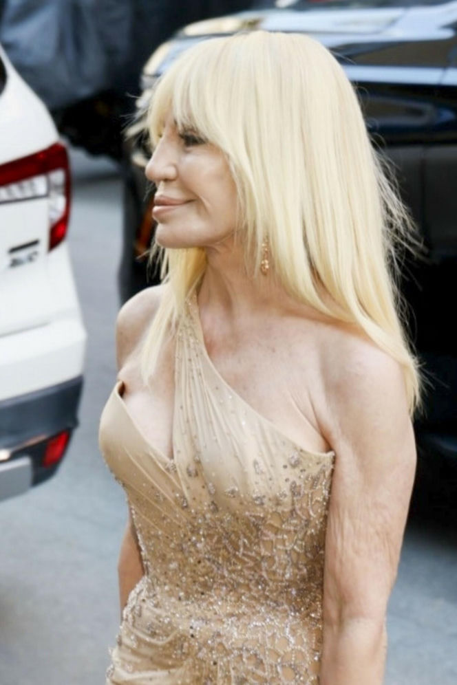 Nowa twarz Donatelli Versace! Zobacz, jak wygląda 71-letnia królowa operacji plastycznych