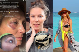 Dramatyczne ferie gwiazd. Kalczyńska wróciła z limem, Tomaszewska uczestniczyła w karambolu, a Folwarską wyproszono z samolotu