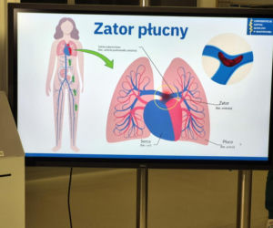 Pazurami wyrywaliśmy ją śmierci. Lekarze z Białegostoku cudem uratowali 36-letnią Justynę