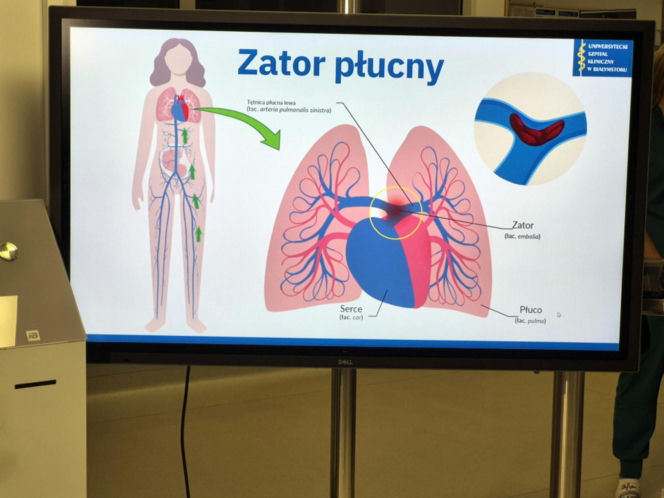"Pazurami wyrywaliśmy ją śmierci". Lekarze z Białegostoku cudem uratowali 36-letnią Justynę