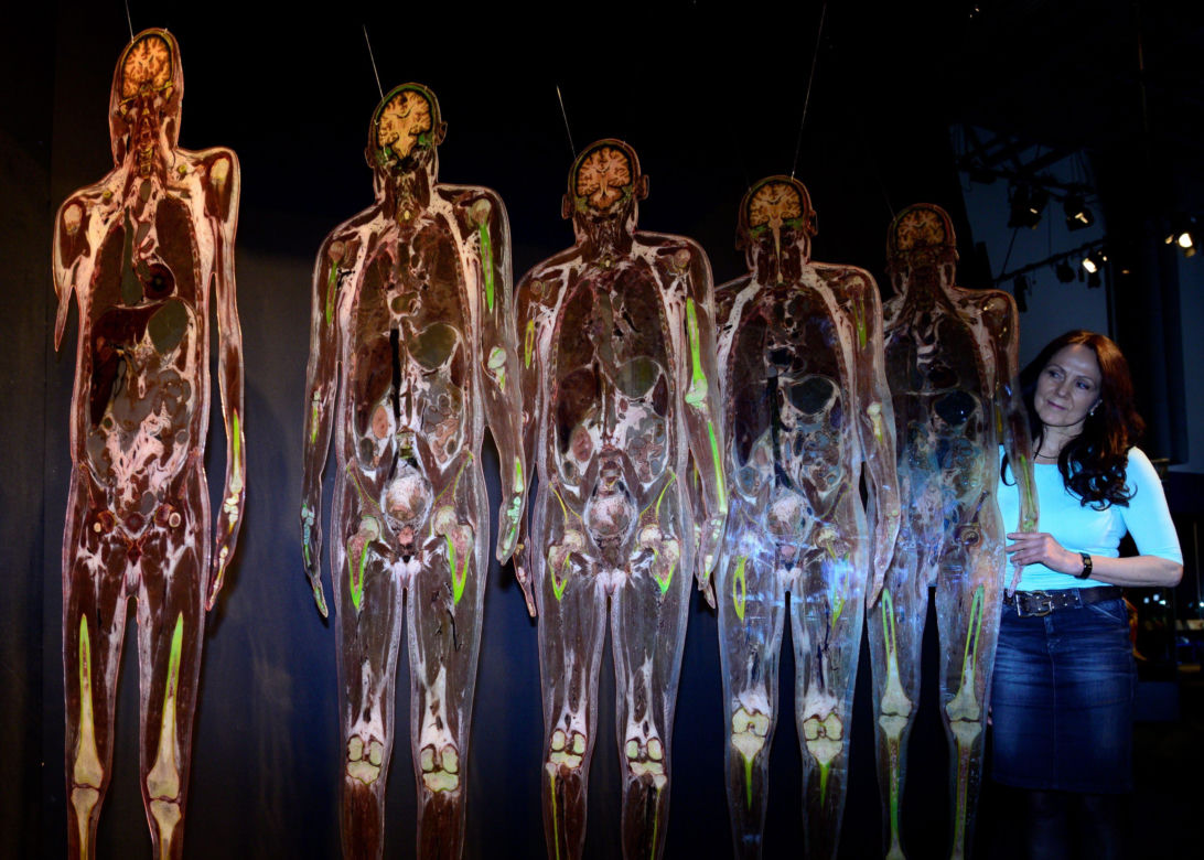 Body Worlds